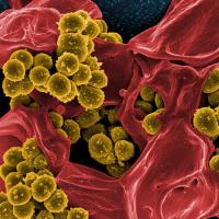 Staphylococcus aureus